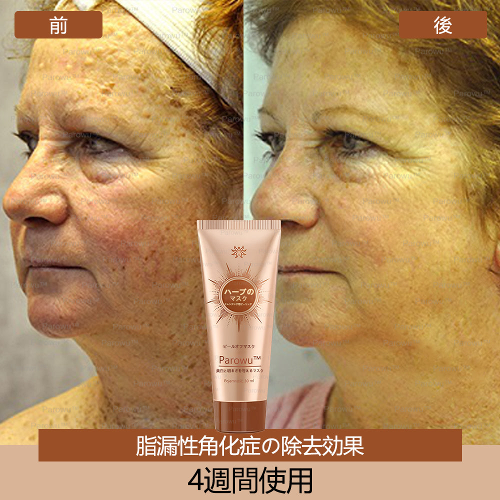 Parowu™シミ・色素沈着除去&美白マスク(✨天然成分でシミ、色素沈着、日焼けによるシミを長期的にケア)