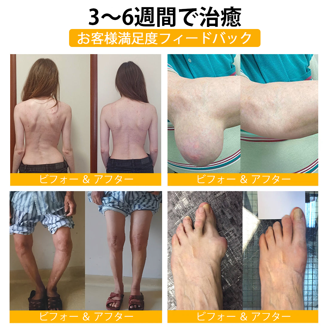 WarmFamily® ボツリヌストキシン&蜂毒配合 骨治癒促進鎮痛クリーム🐝
