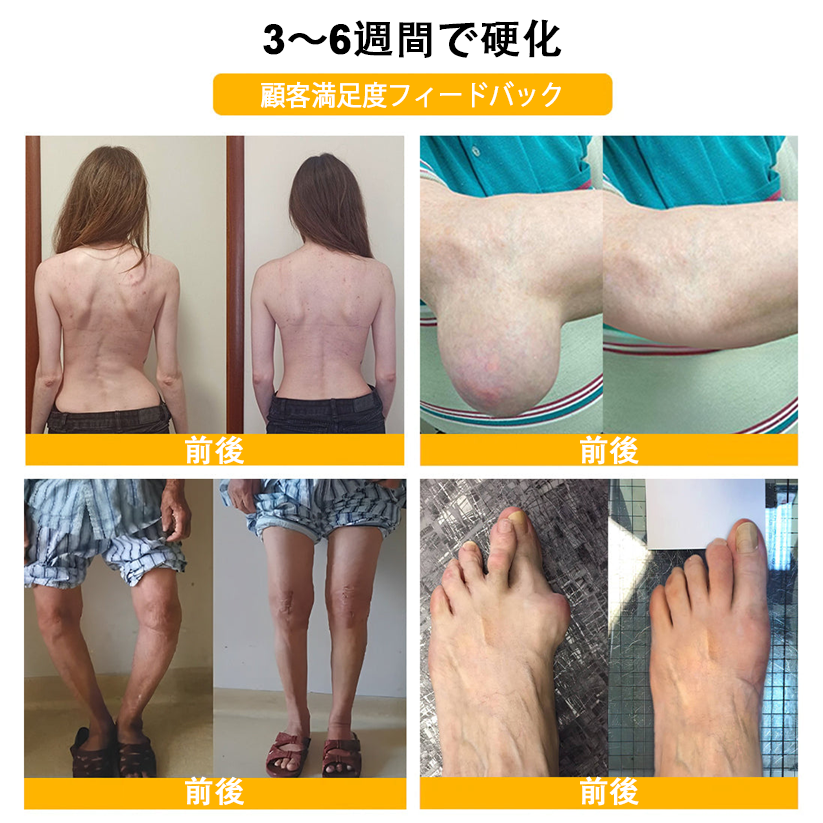 アメリカ製✅🇺🇸TLOPA® ボツリヌストキシン&蜂毒 骨・関節サポートクリーム (👴高齢の方におすすめ!整形外科医も推奨🐝)