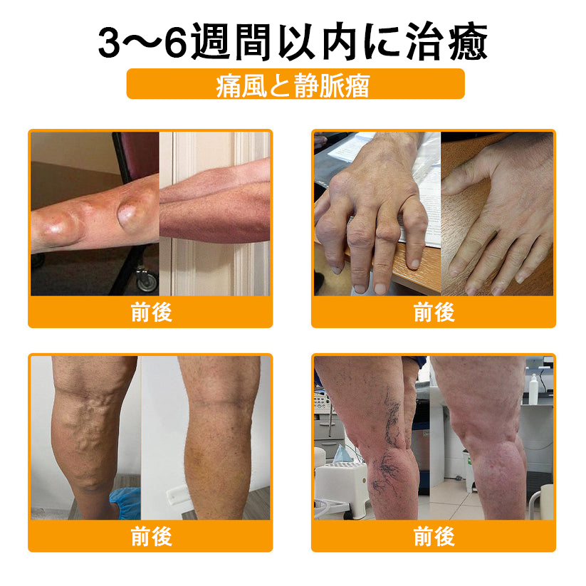 アメリカ製✅🇺🇸TLOPA® ボツリヌストキシン&蜂毒 骨・関節サポートクリーム (👴高齢の方におすすめ!整形外科医も推奨🐝)