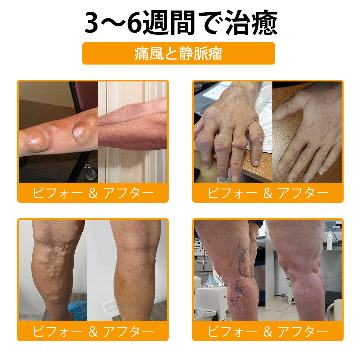 WarmFamily® ボツリヌストキシン&蜂毒配合 骨治癒促進鎮痛クリーム🐝