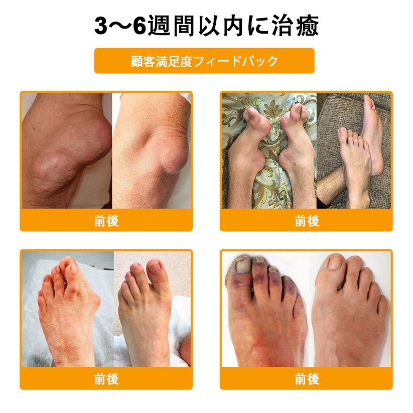 アメリカ製✅🇺🇸TLOPA® ボツリヌストキシン&蜂毒 骨・関節サポートクリーム (👴高齢の方におすすめ!整形外科医も推奨🐝)