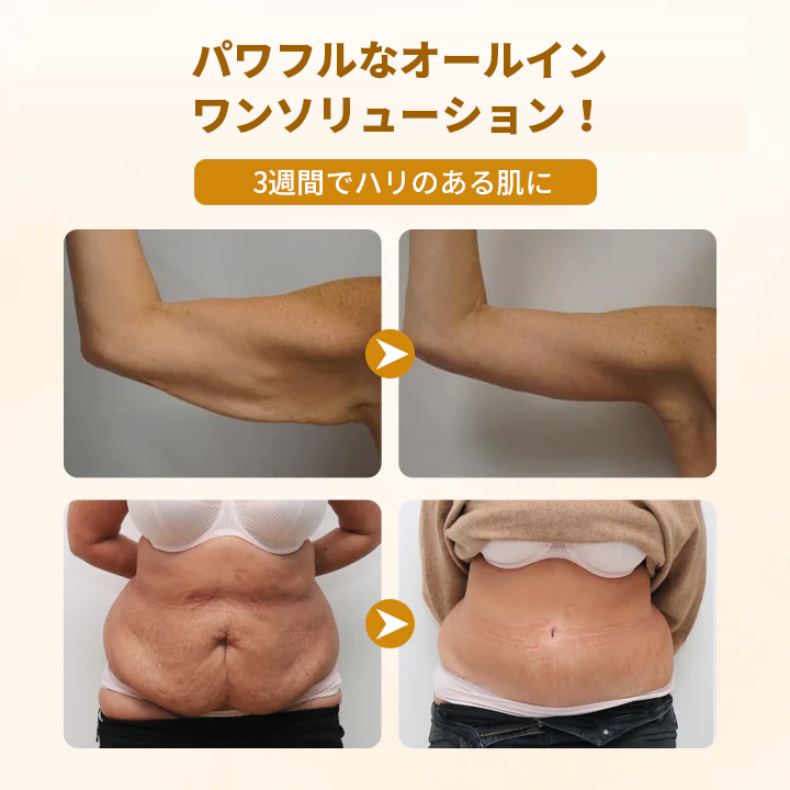 Timilk®✅ ビーヴェノム コンプレックス リペアクリーム