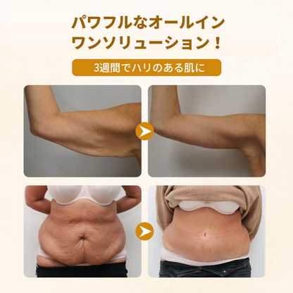 Timilk®✅ ビーヴェノム コンプレックス リペアクリーム