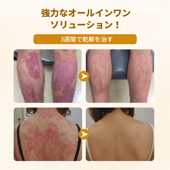 Timilk®✅ ビーヴェノム コンプレックス リペアクリーム