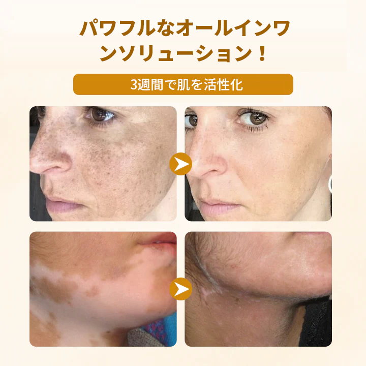 Timilk®✅ ビーヴェノム コンプレックス リペアクリーム