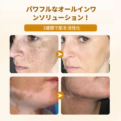 Timilk®✅ ビーヴェノム コンプレックス リペアクリーム