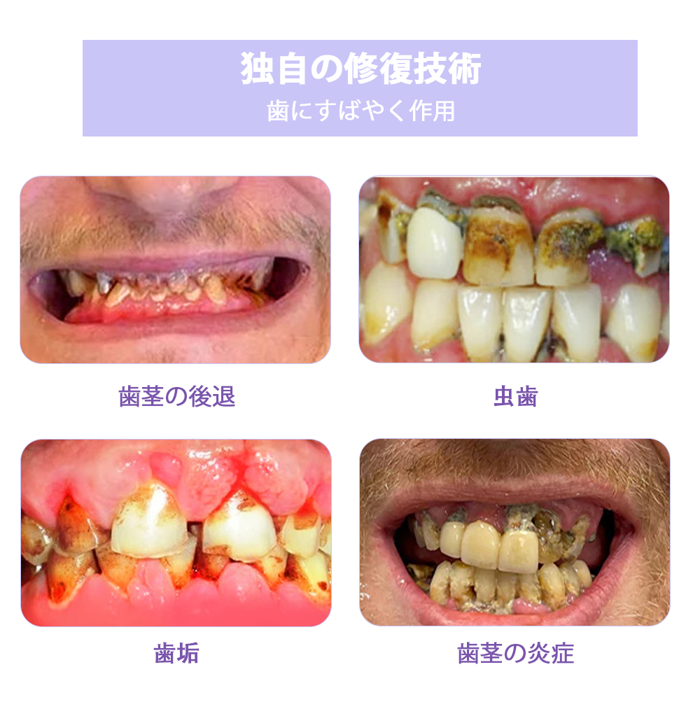Cvreoz®（ADA推奨）ミネラル歯修復パウダー 🦷 残り30分限定！特別割引実施中 🦷